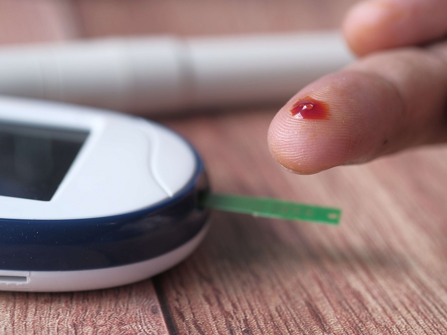 Diabète : un système de mesure de la glycémie sans piqûre